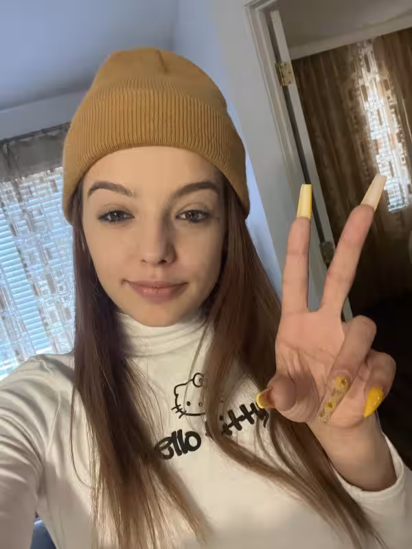 Apple Almi - Photo 1